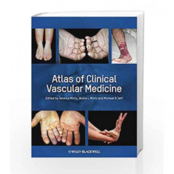 Atlas of Clinical Vascular Medicine by Jaff M.R. Book-9780470658093