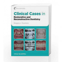 Clinical Cases in Restorative and Reconstructive Dentistry (Clinical Cases (Dentistry)) by Tarantola Book-9780813815640