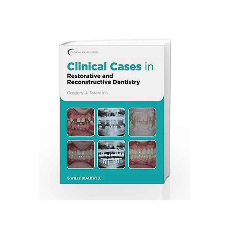 Clinical Cases in Restorative and Reconstructive Dentistry (Clinical Cases (Dentistry)) by Tarantola Book-9780813815640
