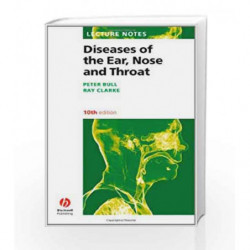 Lecture Notes: Diseases of the Ear, Nose and Throat by Bull P. Book-9781405145084