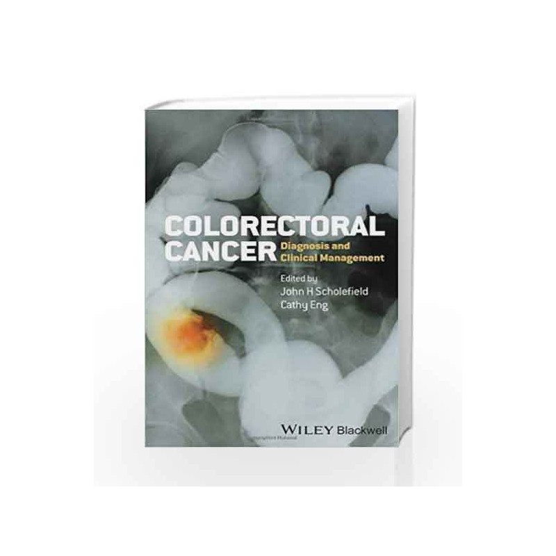 Colorectal Cancer: Diagnosis and Clinical Management by Scholefield Book-9780470674802