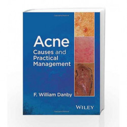 Acne: Causes and Practical Management by Danby Book-9781118232774