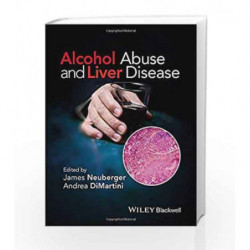 Alcohol Abuse and Liver Disease by Dimartini A Book-9781118887288