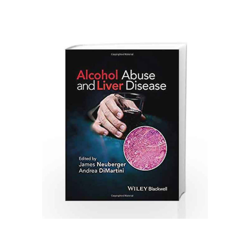 Alcohol Abuse and Liver Disease by Dimartini A Book-9781118887288