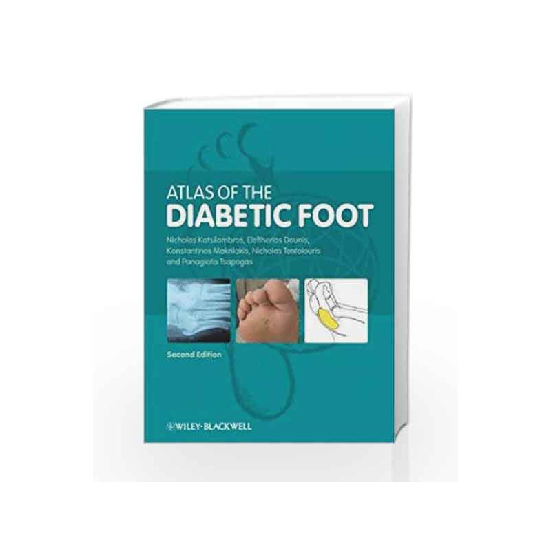 Atlas of the Diabetic Foot by Andropoulos D.B.,Bagchi,Bagchi D,Carroll,Connors,Connors K.A,Dibart,Dibart S.,Hall,Katsilambros,Mc