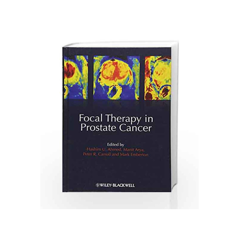 Focal Therapy in Prostate Cancer by Ahmed H.U. Book-9781405196499