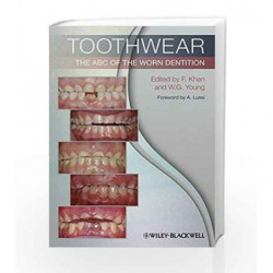 Toothwear: The ABC of the Worn Dentition by Khan F. Book-9781444336559
