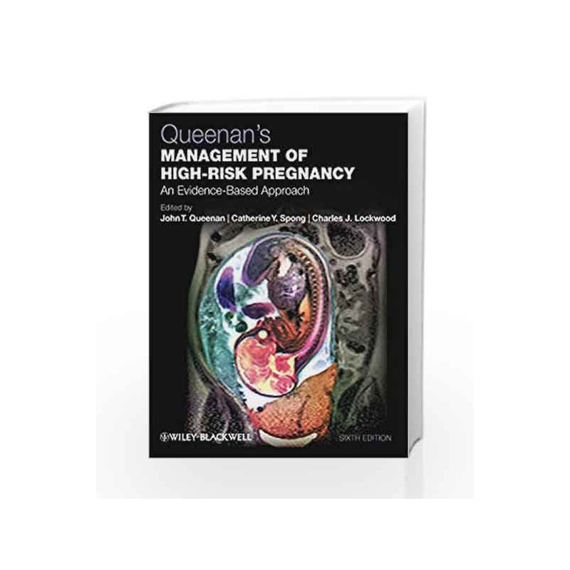 Queenan s Management of HighRisk Pregnancy: An EvidenceBased Approach by Queenan J.T. Book-9780470655764