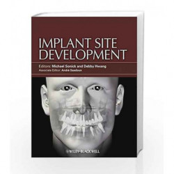 Implant Site Development by Sonick M. Book-9780813825120