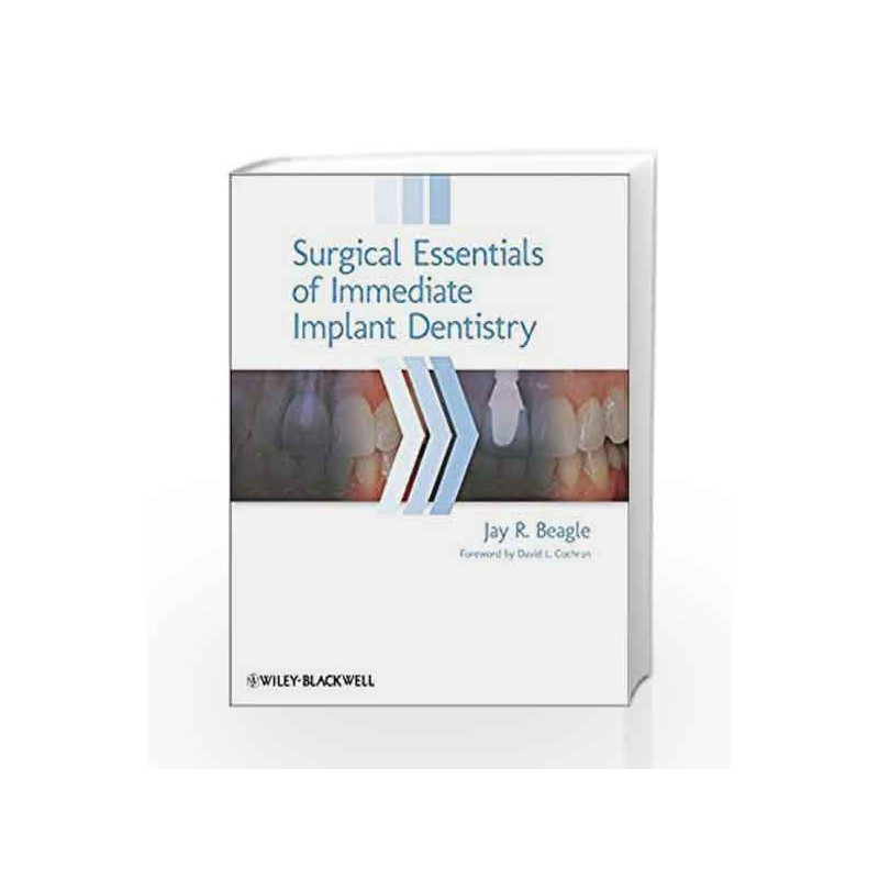 Surgical Essentials of Immediate Implant Dentistry by Beagle J. R. Book-9780813816067