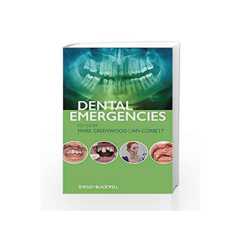 Dental Emergencies by Greenwood M. Book-9780470673966