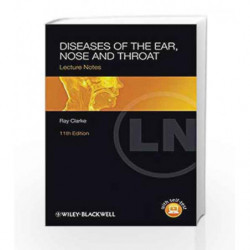 Diseases of the Ear, Nose and Throat (Lecture Notes) by Clarke R Book-9780470655016