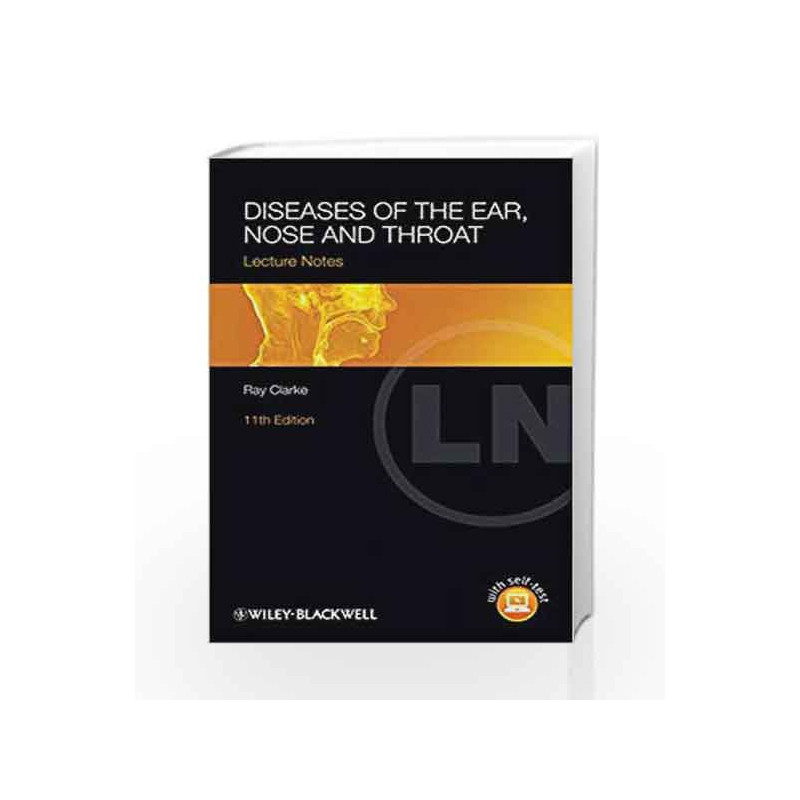 Diseases of the Ear, Nose and Throat (Lecture Notes) by Clarke R Book-9780470655016