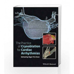 The Practice of Catheter Cryoablation for Cardiac Arrhythmias by Chan Y. Book-9781118451830