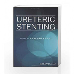 Ureteric Stenting by Kulkarni Book-9781119085683