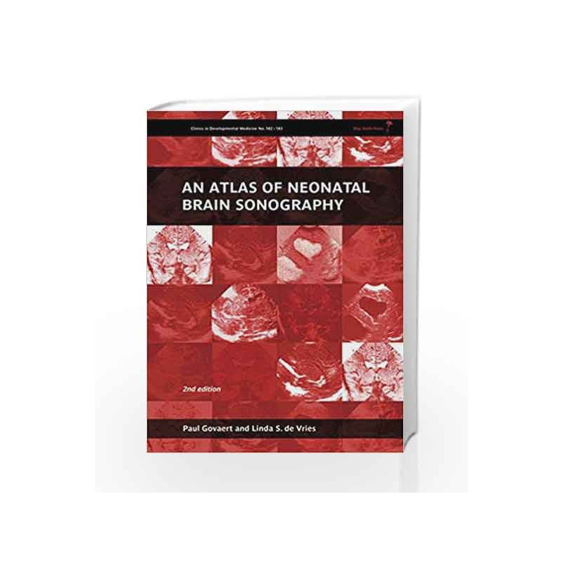 An Atlas of Neonatal Brain Sonography: 182-183 (Clinics in Developmental Medicine) by Govaert P. Book-9781898683568
