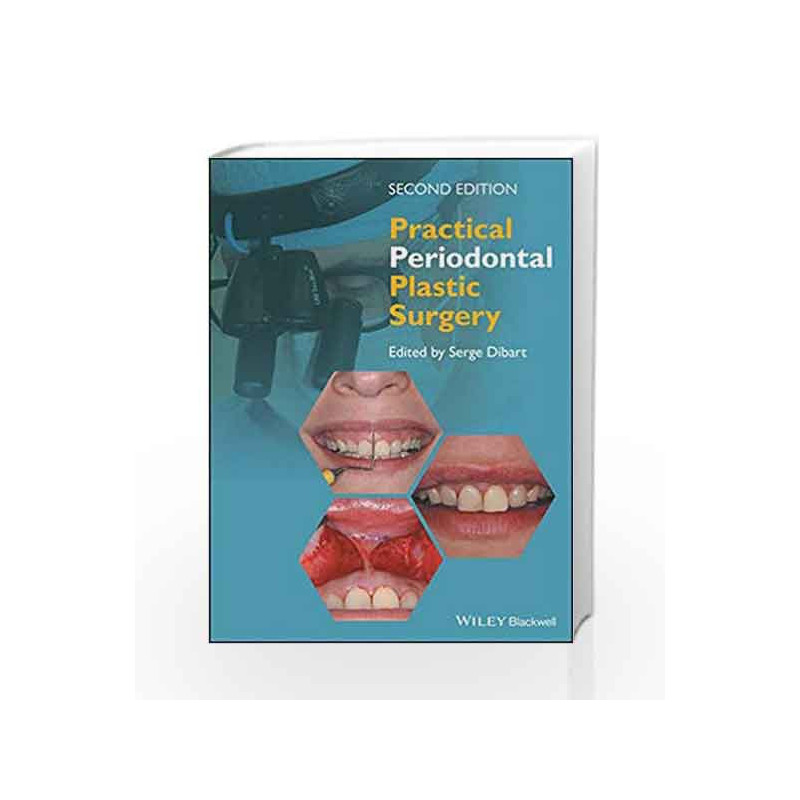 Practical Periodontal Plastic Surgery by Dibart S. Book-9781118360651