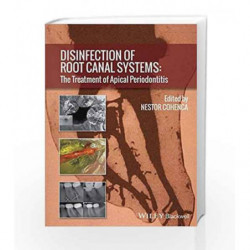 Disinfection of Root Canal Systems: The Treatment of Apical Periodontitis by Cohenca Book-9781118367681