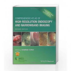 Comprehensive Atlas of HighResolution Endoscopy and Narrowband Imaging by Cohen J. Book-9781118705933