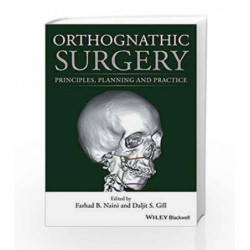 Orthognathic Surgery: Principles, Planning and Practice by Naini F B Book-9781118649978