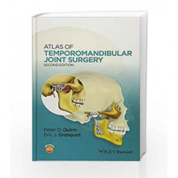 Atlas of Temporomandibular Joint Surgery by Quinn P.D. Book-9781119949855
