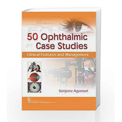 50 Ophthalmic Case Studies...