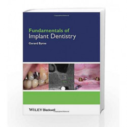 Fundamentals of Implant Dentistry by Byrne Book-9781118274965