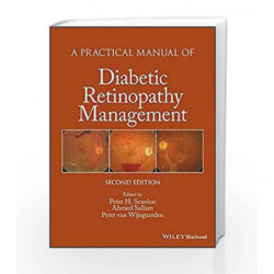 A Practical Manual of Diabetic Retinopathy Management (Practical Manual of Series) by Scanlon P H Book-9781119058953