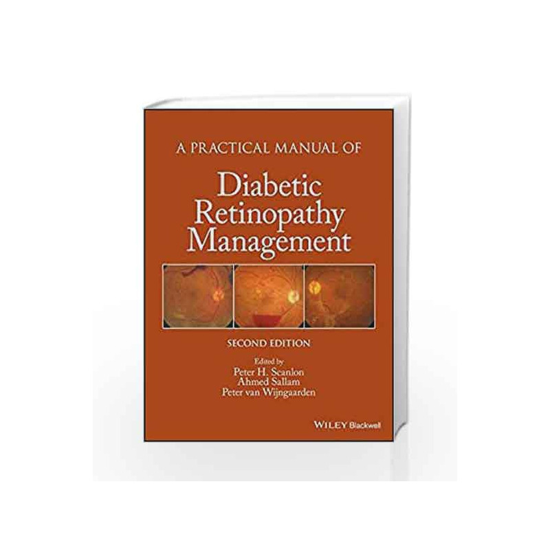 A Practical Manual of Diabetic Retinopathy Management (Practical Manual of Series) by Scanlon P H Book-9781119058953