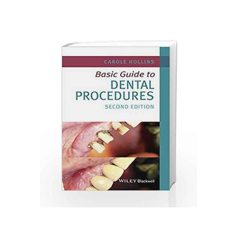 Basic Guide to Dental Procedures (Basic Guide Dentistry Series) by Hollins C. Book-9781118924556