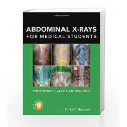 Abdominal Xrays for Medical Students (CourseSmart) by Clarke C. Book-9781118600559