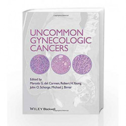 Uncommon Gynecologic Cancers by Carmen M G D Book-9781118655351