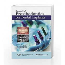 Journal of Prosthodontics on Dental Implants by Bidra A Book-9781119115366