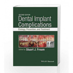 Dental Implant Complications: Etiology, Prevention, and Treatment by Froum S J Book-9781118976456