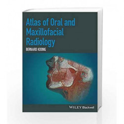 Atlas of Oral and Maxillofacial Radiology by Koong B Book-9781118939642