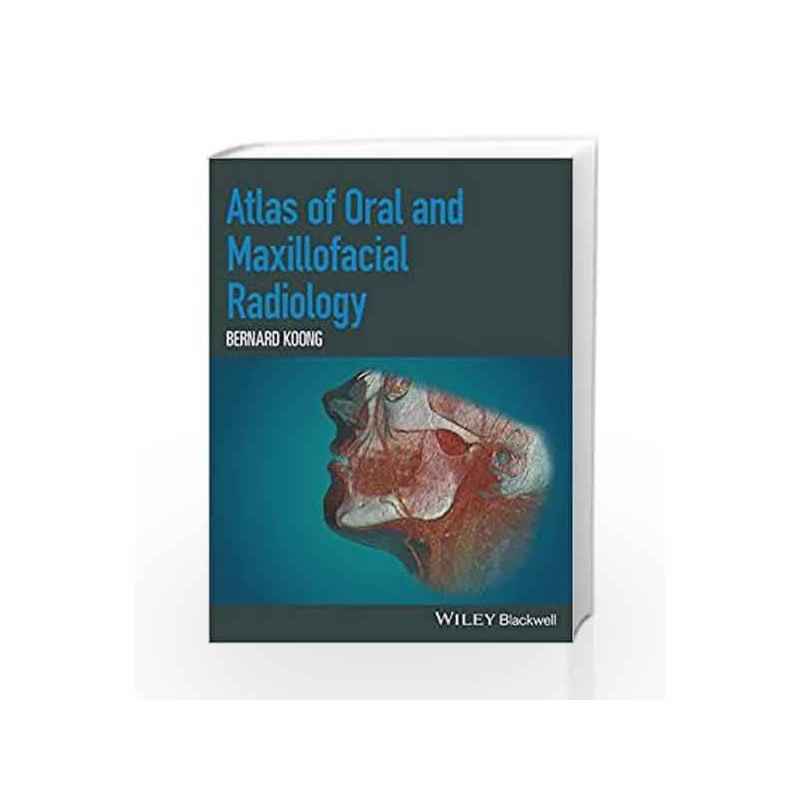 Atlas of Oral and Maxillofacial Radiology by Koong B Book-9781118939642