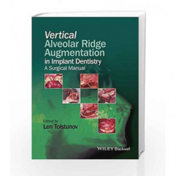 Vertical Alveolar Ridge Augmentation in Implant Dentistry: A Surgical Manual by Tolstunov L Book-9781119082590
