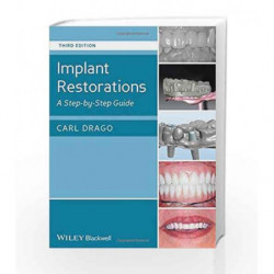 Implant Restorations: A StepbyStep Guide by Dargo C Book-9781118513057