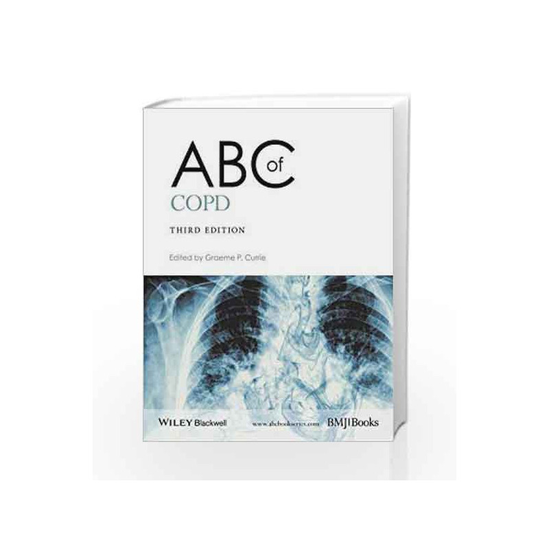 ABC of COPD (ABC Series) by Currie G P Book-9781119212850