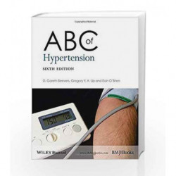 ABC of Hypertension (ABC Series) by Beevers G. Book-9780470659625