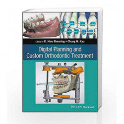 Digital Planning and Custom Orthodontic Treatment by Breuning K H Book-9781119087779