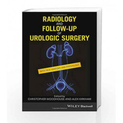Radiology and Followup of Urologic Surgery by Woodhouse C R J Book-9781119162087