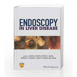 Endoscopy in Liver Disease by Plevris J N Book-9781118660874