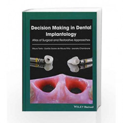 Decision Making in Dental Implantology: Atlas of Surgical and Restorative Approaches by Tosta M Book-9781119225942