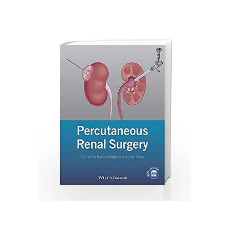Percutaneous Renal Surgery by Monga M. Book-9781118278734