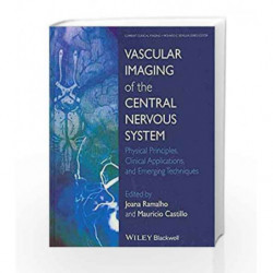 Vascular Imaging Of The Central Nervous System: Physical Principles, Clinical Applications And Emerging Techniques (Hb 2014) by 