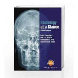 Radiology at a Glance by Chowdhury Book-9781118914779