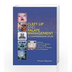 Cleft Lip and Palate Management: A Comprehensive Atlas by Bennun R D Book-9781118607541