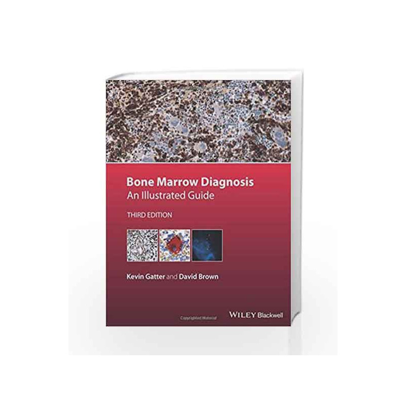 Bone Marrow Diagnosis: An Illustrated Guide by Gatter K Book-9781118253656