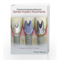 Clinical and Laboratory Manual of Dental Implant Abutments by Shafie Book-9781119949817